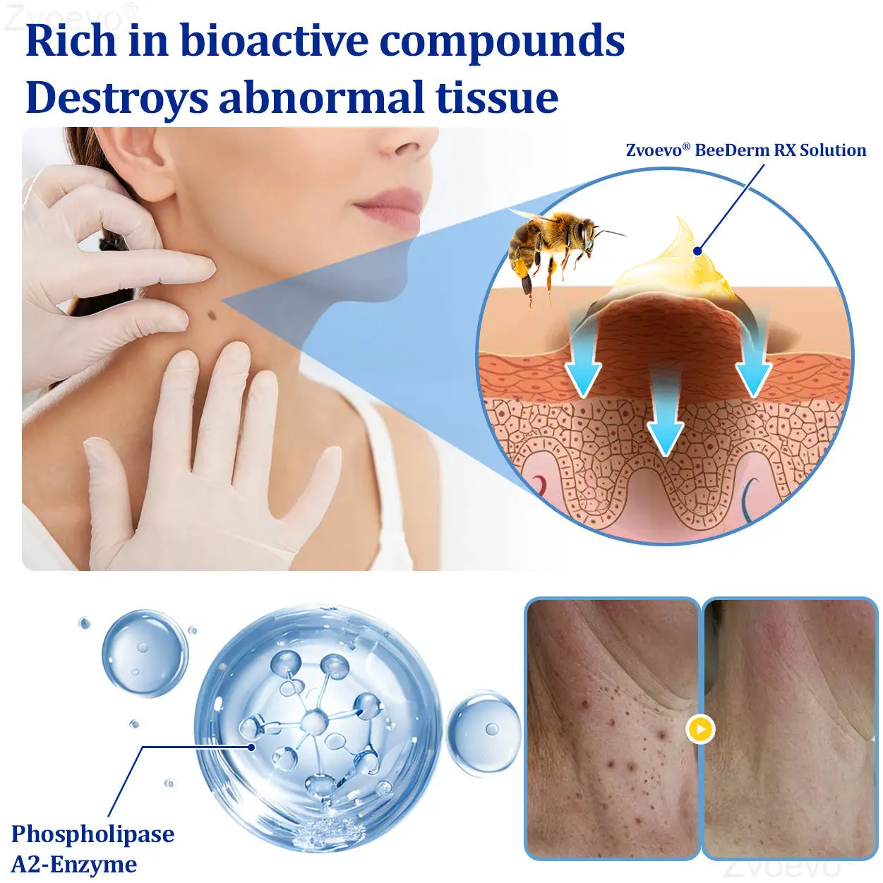 BeeDerm RX Solution - Image 3