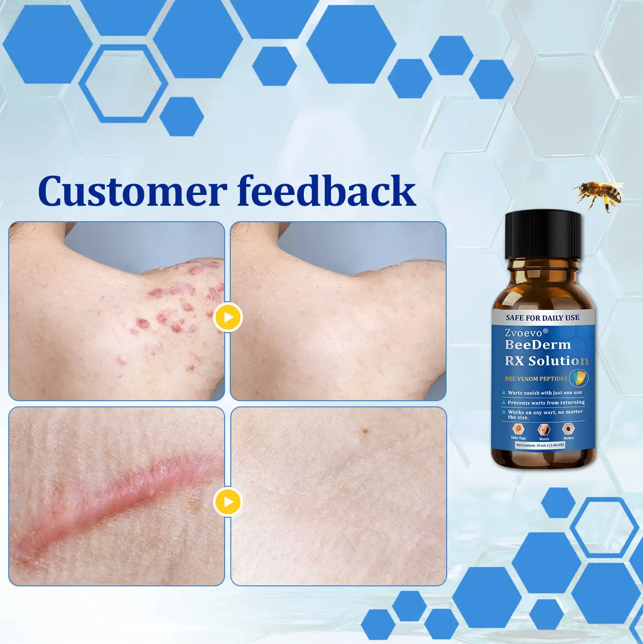 BeeDerm RX Solution - Image 4