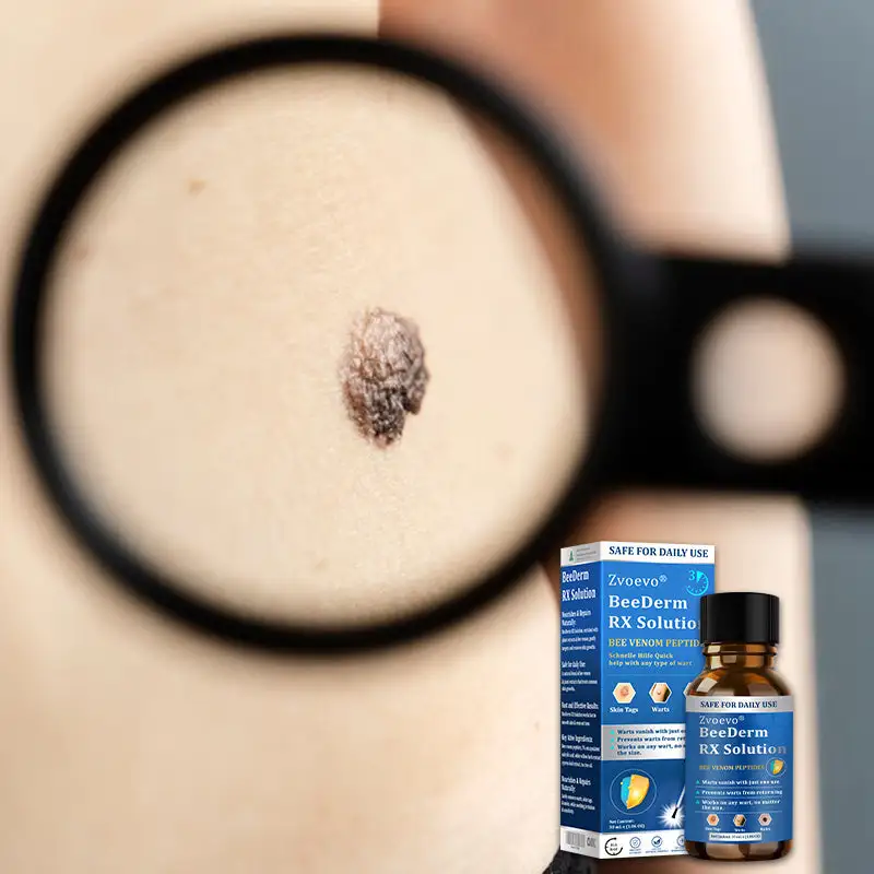 BeeDerm RX Solution - Image 5