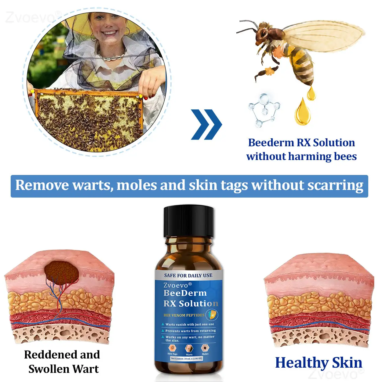 BeeDerm RX Solution - Image 7