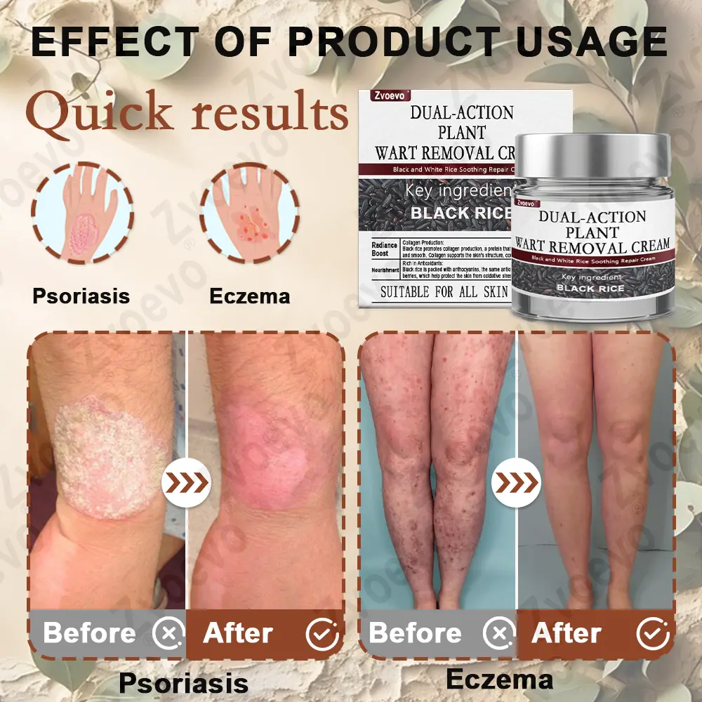 Black Rice Skin Repair Essence Cream - Image 12