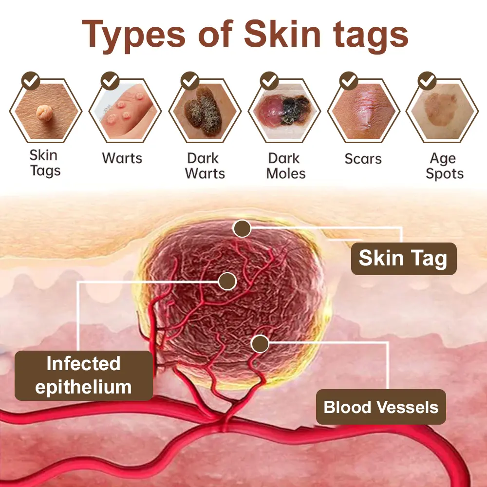 Black Rice Skin Repair Essence Cream - Image 9