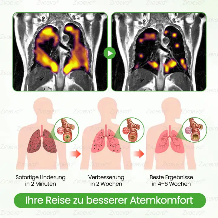 Botanischer Mullein Lungenreinigungsdiffusor - Image 6