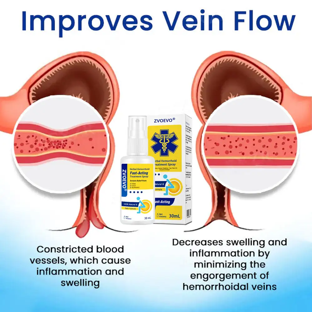 Herbal Hemorrhoids Fast-Acting Treatment Spray - Image 4