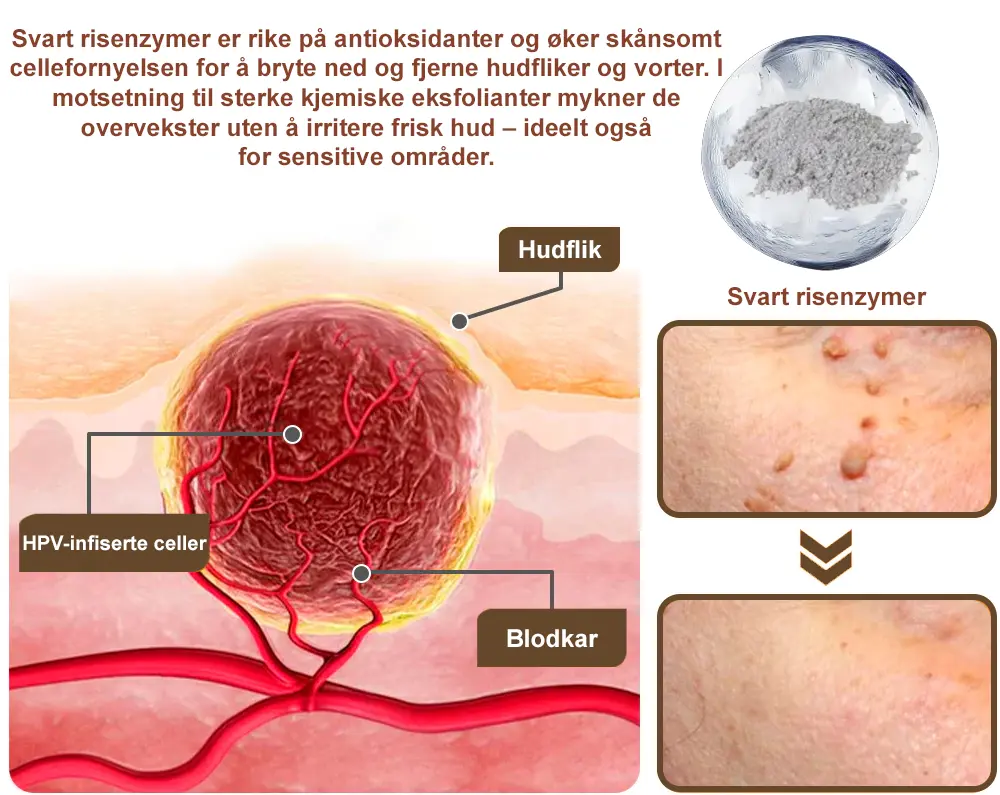 Svart ris hudreparerende essenskrem - Image 9