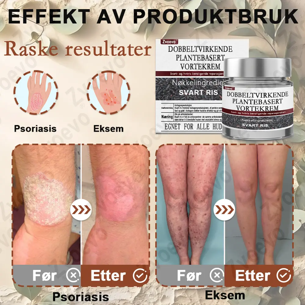 Svart ris hudreparerende essenskrem - Image 11