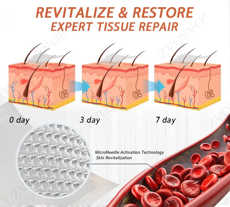 Vein Ease Microneedle Care Patch - Image 10