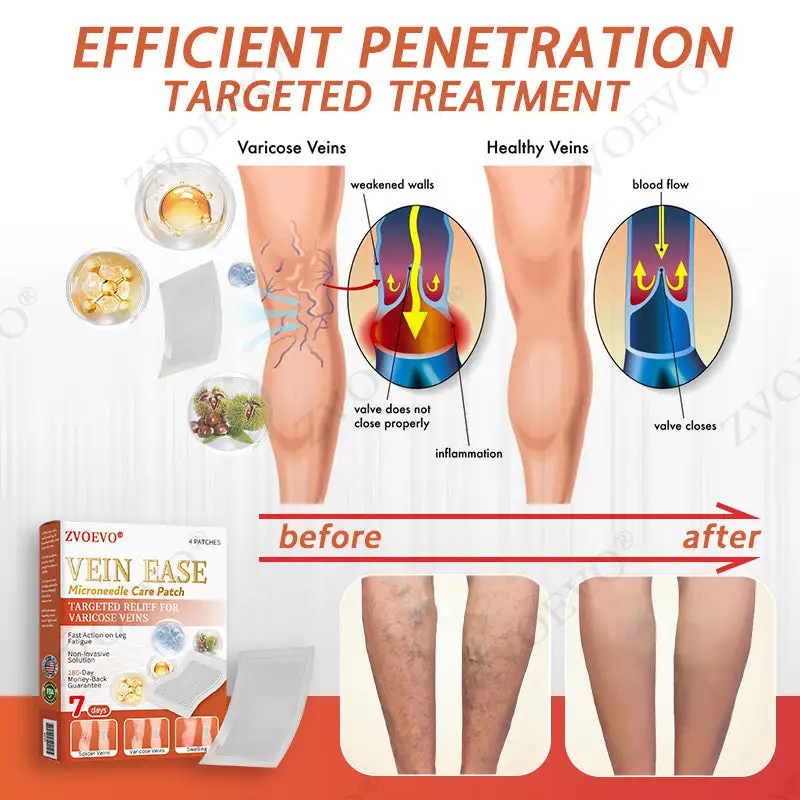 Vein Ease Microneedle Care Patch - Image 8