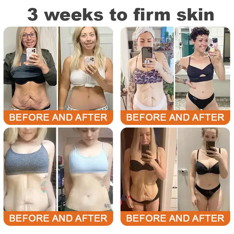 Bee Venom Restorative Cream - Image 4