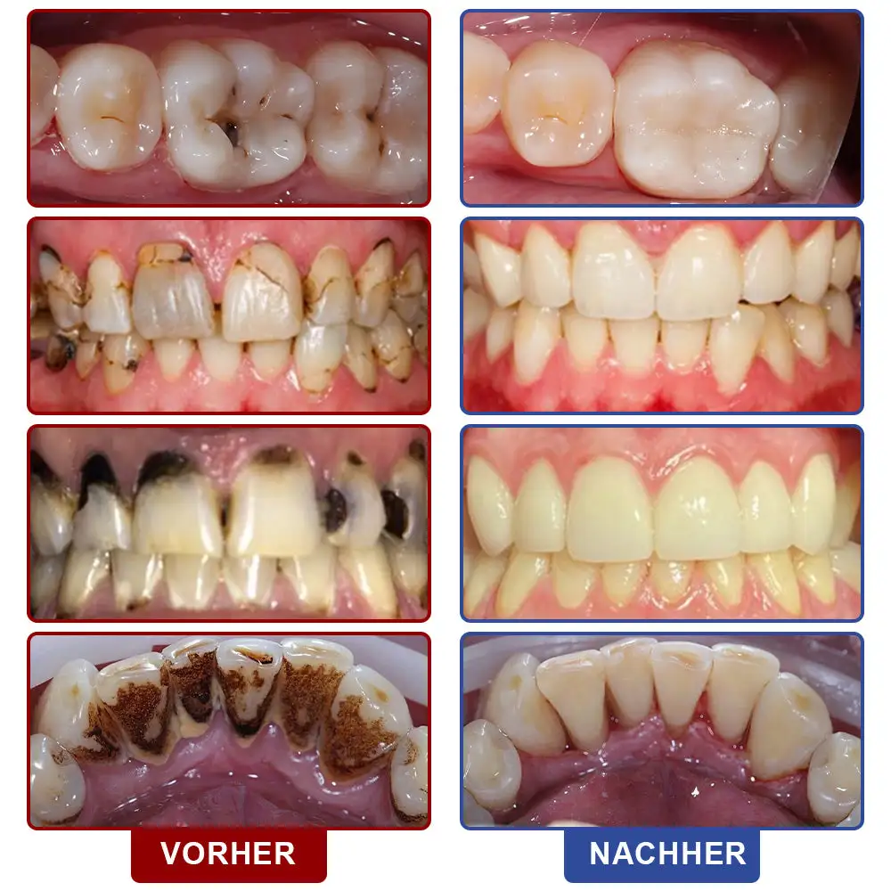 ๐๐๐ก๐ง๐ฌ๐๐ก๐ฎ๐ญ๐ณ & ๐๐๐ก๐ง๐ซ๐๐ ๐๐ง๐๐ซ๐๐ญ๐ข๐จ๐ง ๐
๐ฅรผ๐ฌ๐ฌ๐ข๐ ๐ค๐๐ข๐ญ - Image 8